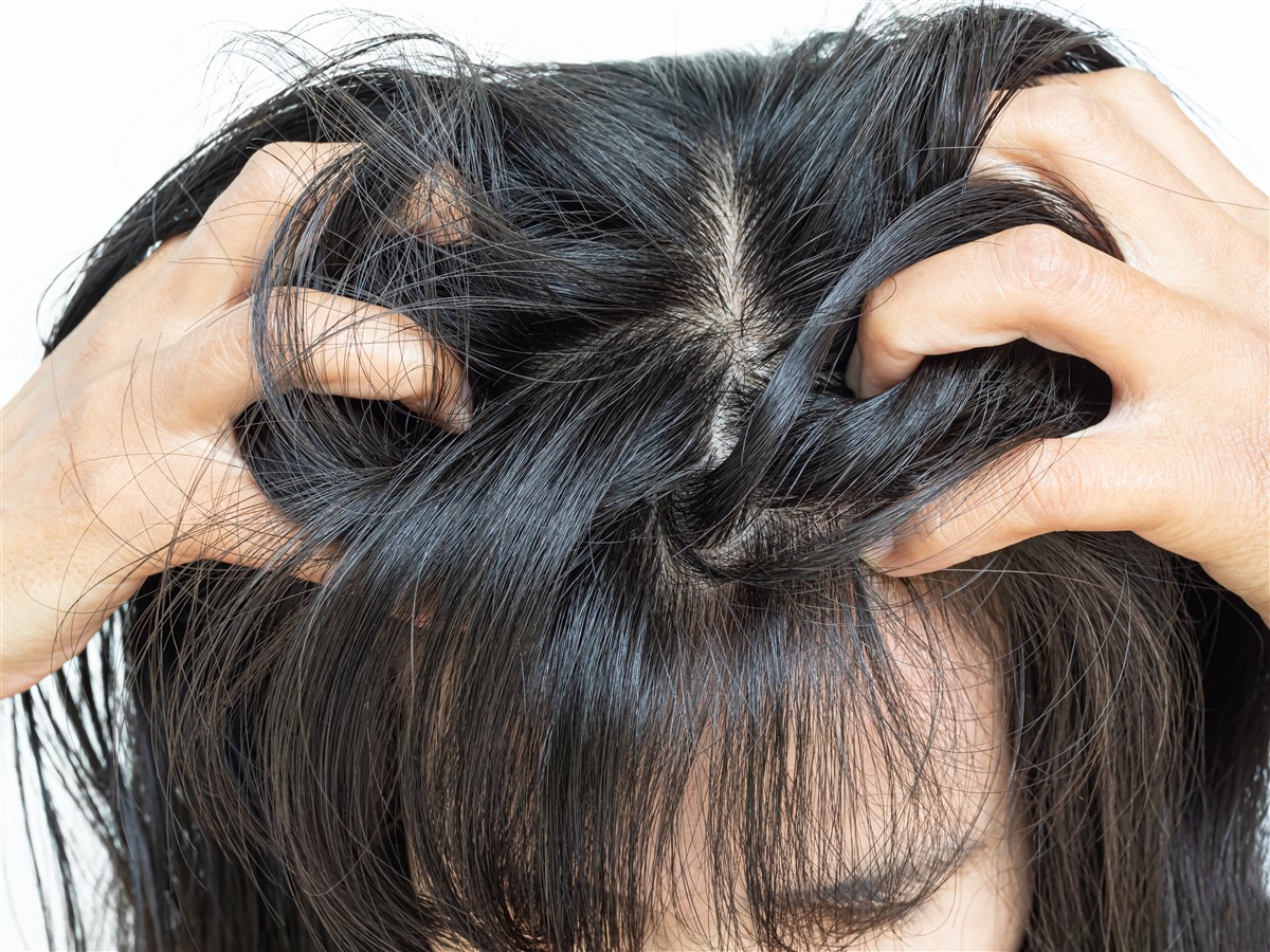 démangeaisons des cheveux